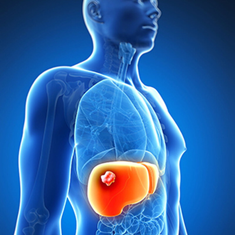 常常感到疲勞？小心「肝」不好！告訴你該吃的4種護肝保健食品推薦！