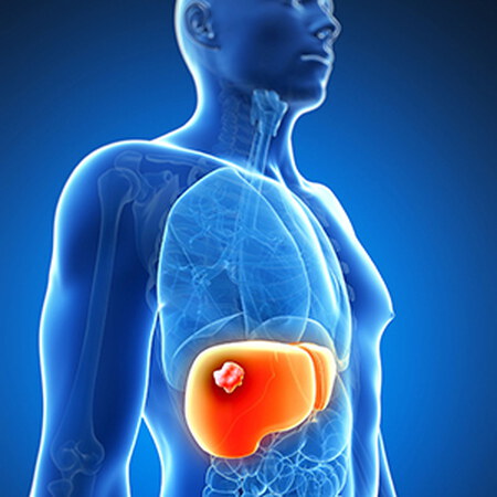 常常感到疲勞？小心「肝」不好！告訴你該吃的4種護肝保健食品推薦！