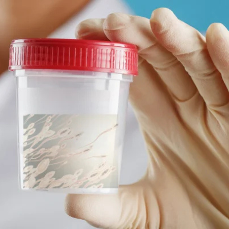 精液分析檢查要看哪一科、做什麼項目？精蟲各項標準值？