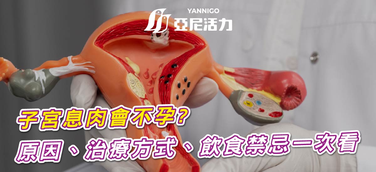 子宮息肉會影響懷孕？症狀、原因與治療方式一次看