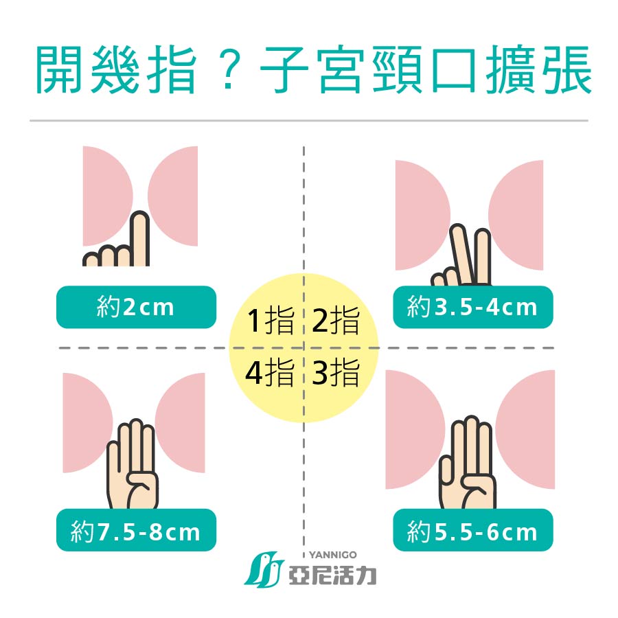 開幾指,宮縮,子宮頸開幾指 開幾指,宮縮,子宮頸開幾指
