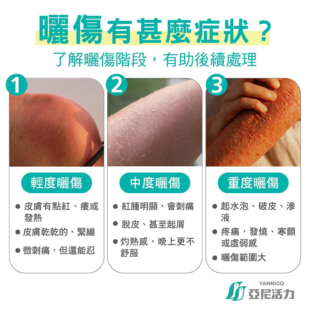 曬傷有什麼症狀