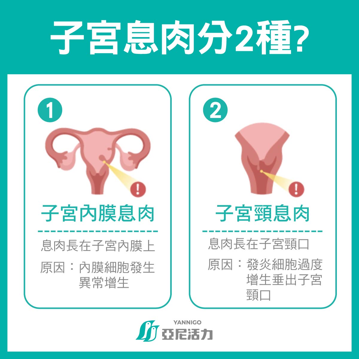 子宮息肉是什麼